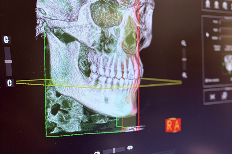 3D Imaging in Los Angeles